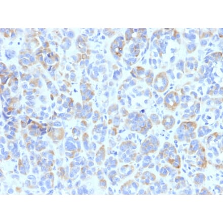 Immunohistochemistry - Anti-TRP1 Antibody [TYRP1/807] - BSA and Azide free (A253432) - Antibodies.com