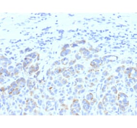 Immunohistochemistry - Anti-TRP1 Antibody [SPM611] - BSA and Azide free (A253434) - Antibodies.com