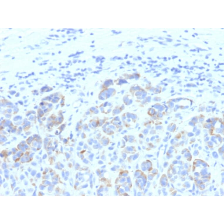Immunohistochemistry - Anti-TRP1 Antibody [SPM611] - BSA and Azide free (A253434) - Antibodies.com