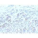 Immunohistochemistry - Anti-TRP1 Antibody [SPM611] - BSA and Azide free (A253434) - Antibodies.com