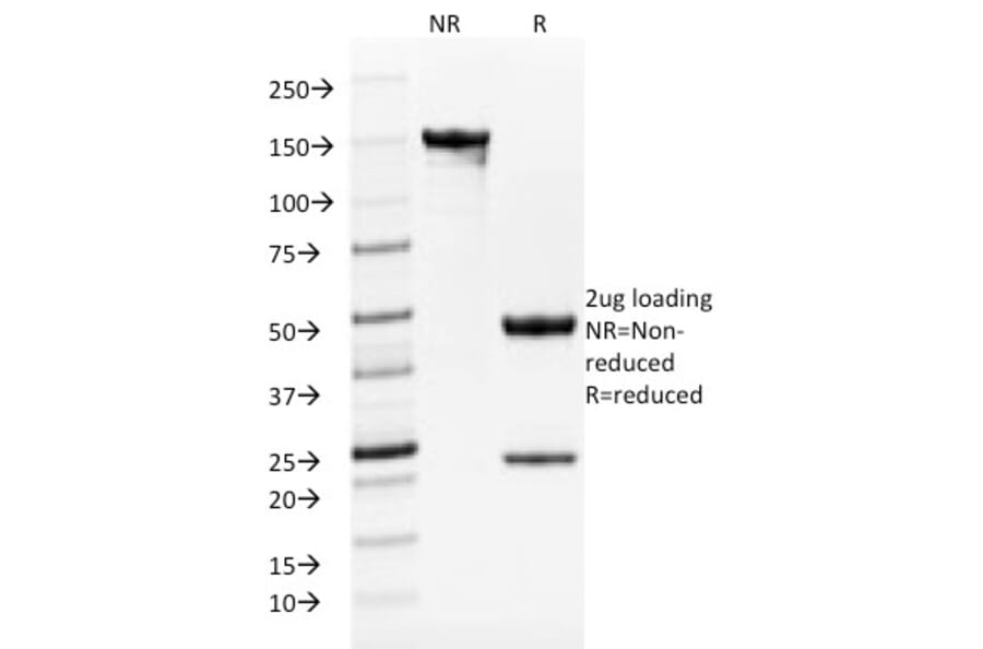 SDS-PAGE - Anti-TRP1 Antibody [TYRP1/1986] - BSA and Azide free (A253437) - Antibodies.com