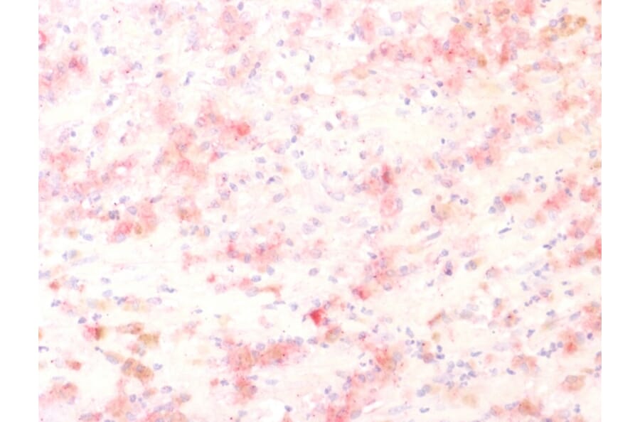 Immunohistochemistry - Anti-TRP1 Antibody [TYRP1/1564R] - BSA and Azide free (A253437) - Antibodies.com