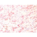 Immunohistochemistry - Anti-TRP1 Antibody [TYRP1/1564R] - BSA and Azide free (A253437) - Antibodies.com