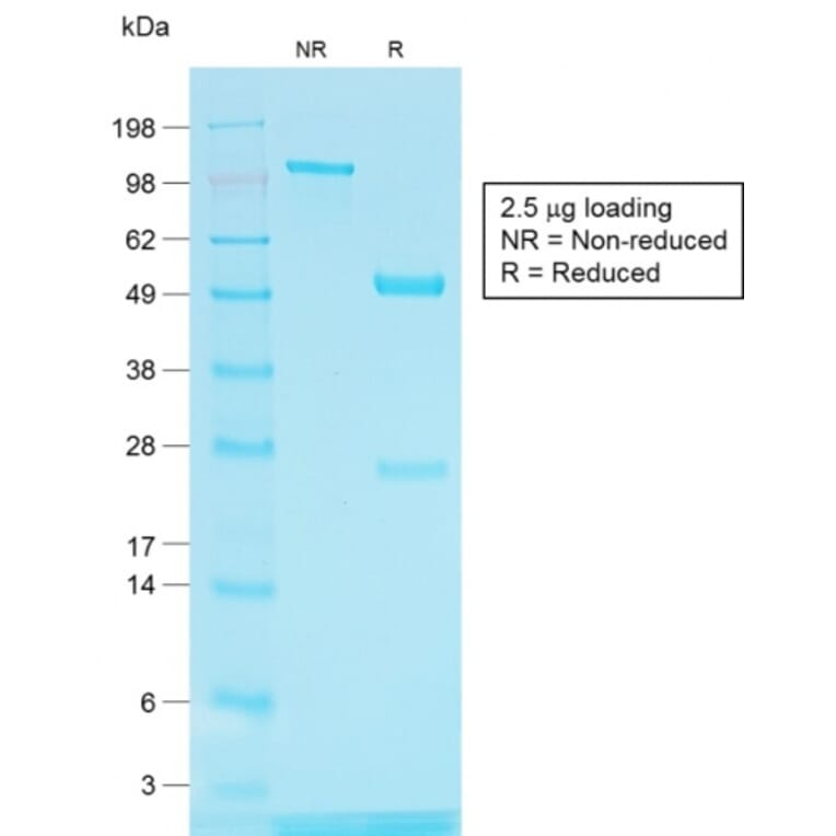 SDS-PAGE - Anti-TRP1 Antibody [TYRP1/1564R] - BSA and Azide free (A253438) - Antibodies.com