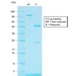 SDS-PAGE - Anti-TRP1 Antibody [TYRP1/1564R] - BSA and Azide free (A253438) - Antibodies.com