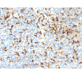 Immunohistochemistry - Anti-TRP1 Antibody [TYRP1/2340R] - BSA and Azide free (A253439) - Antibodies.com