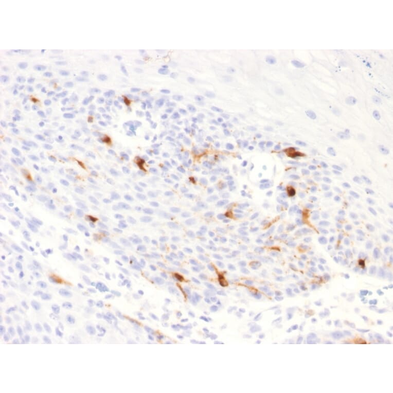 Immunohistochemistry - Anti-TRP1 Antibody [TYRP1/2340R] - BSA and Azide free (A253438) - Antibodies.com