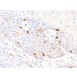 Immunohistochemistry - Anti-TRP1 Antibody [TYRP1/2340R] - BSA and Azide free (A253438) - Antibodies.com