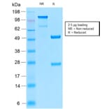 SDS-PAGE - Anti-TRP1 Antibody [TYRP1/2340R] - BSA and Azide free (A253439) - Antibodies.com