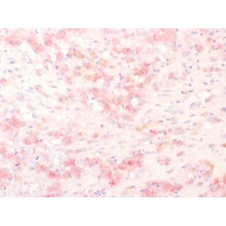 Immunohistochemistry - Anti-TRP1 Antibody - BSA and Azide free (A253440) - Antibodies.com