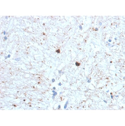 Immunohistochemistry - Anti-Ubiquitin Antibody [UBB/1748] - BSA and Azide free (A253441) - Antibodies.com