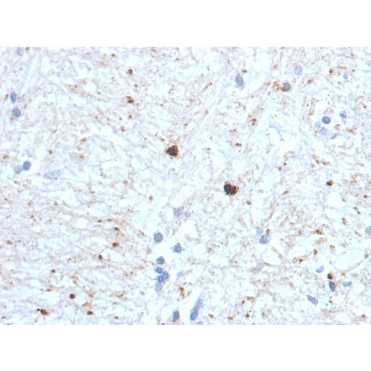 Immunohistochemistry - Anti-Ubiquitin Antibody [UBB/1748] - BSA and Azide free (A253441) - Antibodies.com