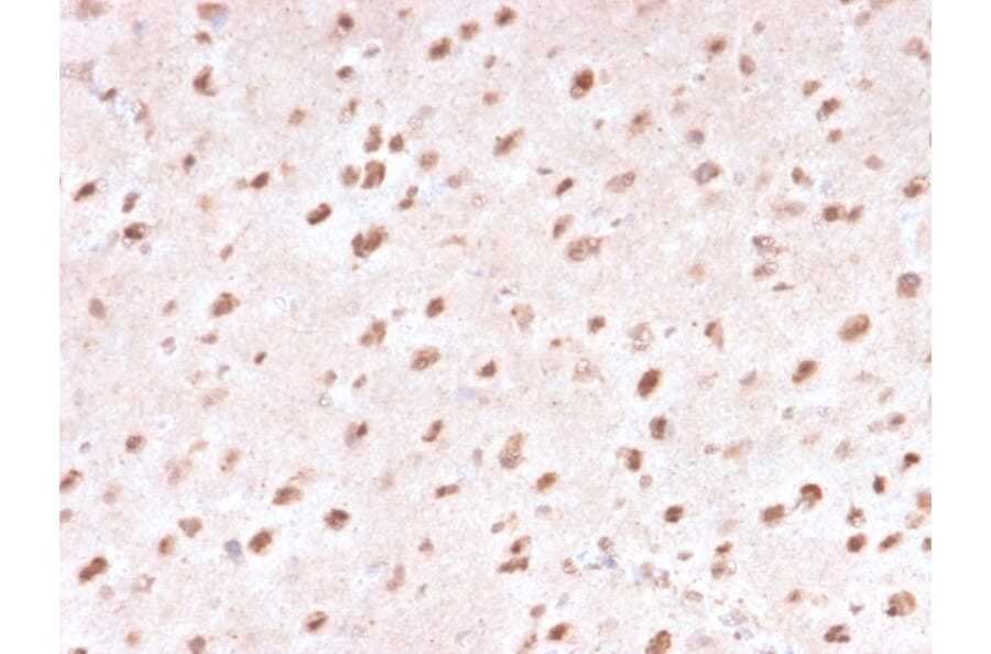 Immunohistochemistry - Anti-Ubiquitin Antibody [UBB/1748] - BSA and Azide free (A253441) - Antibodies.com