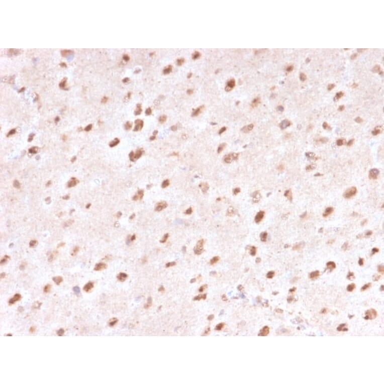 Immunohistochemistry - Anti-Ubiquitin Antibody [UBB/1748] - BSA and Azide free (A253441) - Antibodies.com