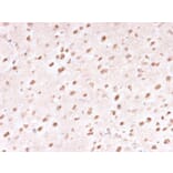 Immunohistochemistry - Anti-Ubiquitin Antibody [UBB/1748] - BSA and Azide free (A253441) - Antibodies.com
