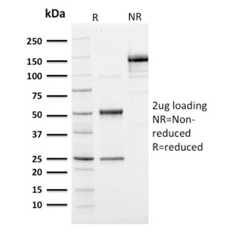 SDS-PAGE - Anti-Ubiquitin Antibody [UBB/1748] - BSA and Azide free (A253441) - Antibodies.com