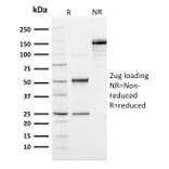 SDS-PAGE - Anti-Ubiquitin Antibody [UBB/1748] - BSA and Azide free (A253441) - Antibodies.com