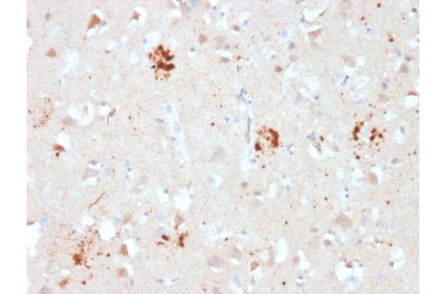 Immunohistochemistry - Anti-Ubiquitin Antibody [UBB/2122] - BSA and Azide free (A253442) - Antibodies.com