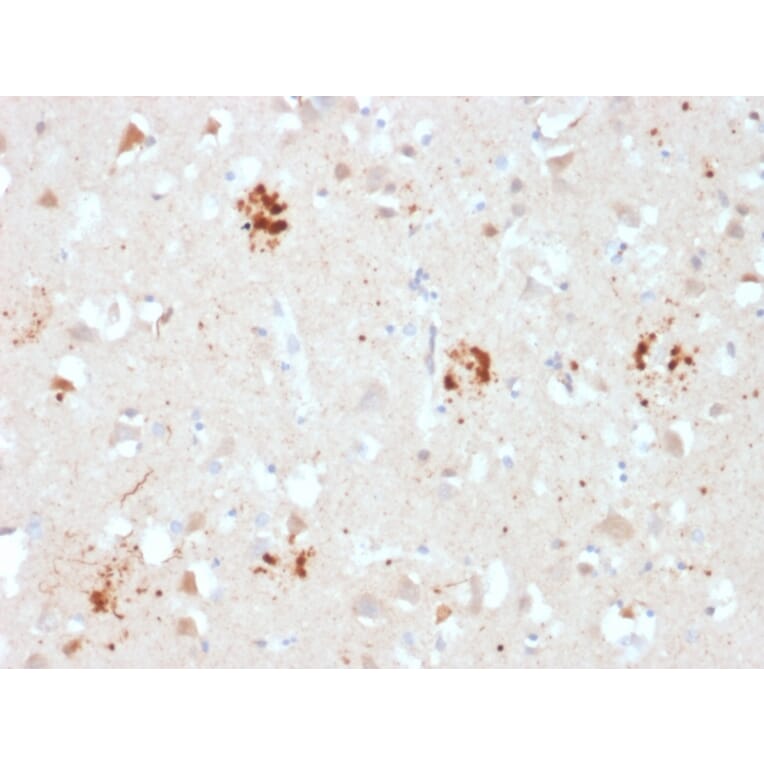 Immunohistochemistry - Anti-Ubiquitin Antibody [UBB/2122] - BSA and Azide free (A253442) - Antibodies.com