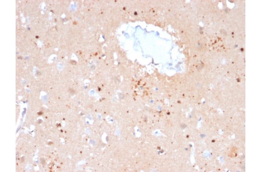 Immunohistochemistry - Anti-Ubiquitin Antibody [UBB/2122] - BSA and Azide free (A253442) - Antibodies.com