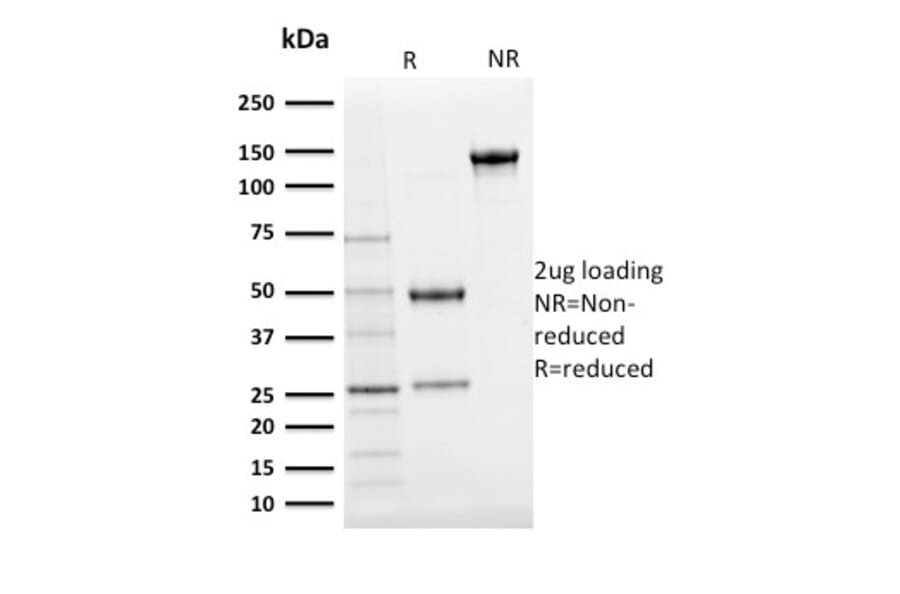 SDS-PAGE - Anti-Ubiquitin Antibody [UBB/2122] - BSA and Azide free (A253442) - Antibodies.com