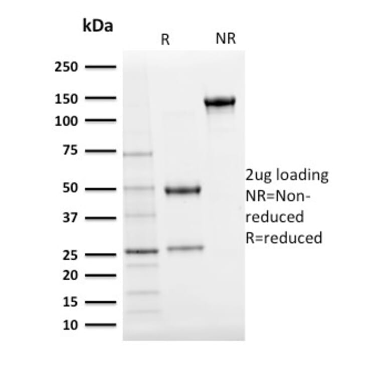 SDS-PAGE - Anti-Ubiquitin Antibody [UBB/2122] - BSA and Azide free (A253442) - Antibodies.com