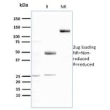 SDS-PAGE - Anti-Ubiquitin Antibody [UBB/3143R] - BSA and Azide free (A253443) - Antibodies.com