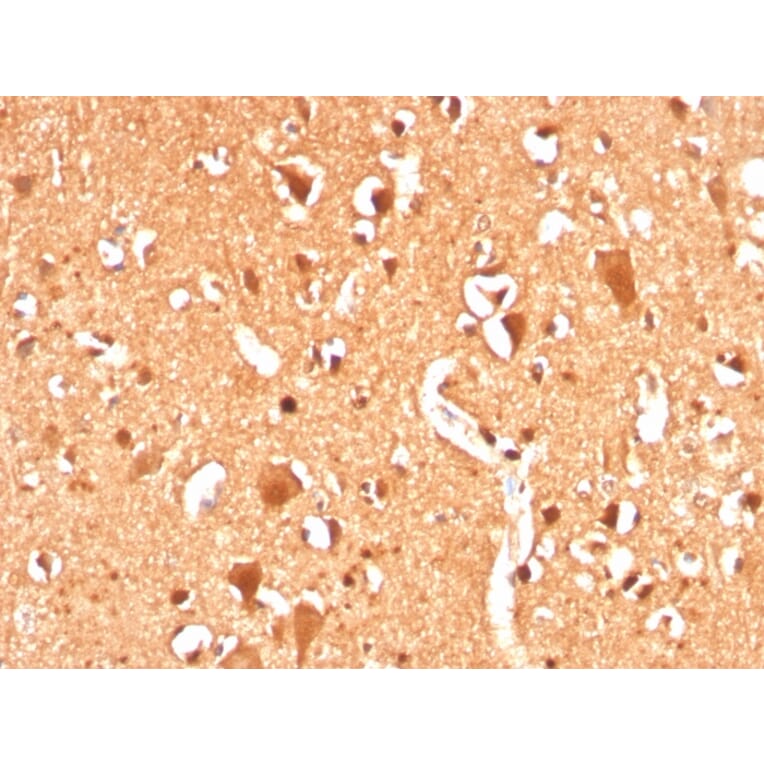 Immunohistochemistry - Anti-Ubiquitin Antibody [UBB/3143R] - BSA and Azide free (A253442) - Antibodies.com