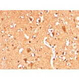 Immunohistochemistry - Anti-Ubiquitin Antibody [UBB/3143R] - BSA and Azide free (A253442) - Antibodies.com