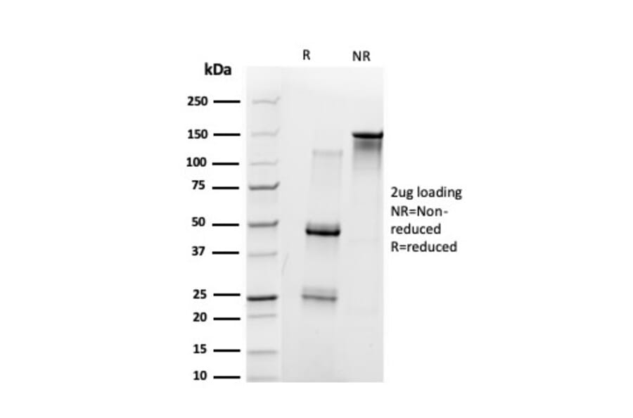 SDS-PAGE - Anti-UBE3A Antibody [PCRP-UBE3A-1A2] - BSA and Azide free (A253445) - Antibodies.com