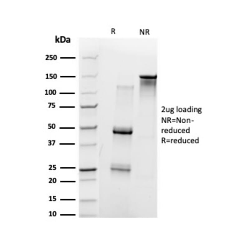 SDS-PAGE - Anti-UBE3A Antibody [PCRP-UBE3A-1A2] - BSA and Azide free (A253445) - Antibodies.com