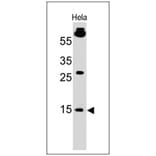Western Blot - Anti-SUMO-1 Antibody [SM1/495] - BSA and Azide free (A253446) - Antibodies.com