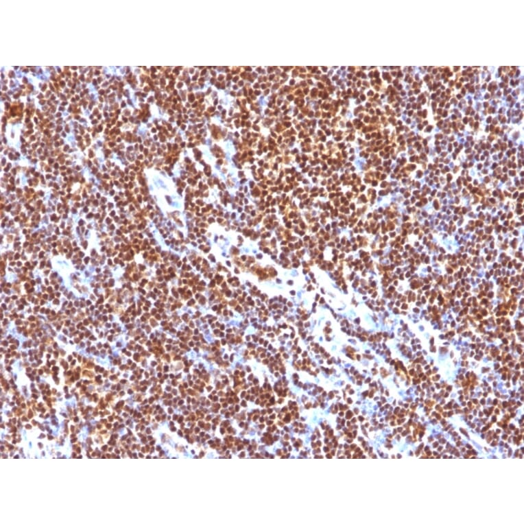Immunohistochemistry - Anti-SUMO-1 Antibody [SUMO1/1188] - BSA and Azide free (A253448) - Antibodies.com
