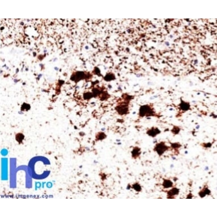 Immunohistochemistry - Anti-PGP9.5 Antibody [31A3] - BSA and Azide free (A253449) - Antibodies.com