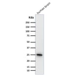 Western Blot - Anti-PGP9.5 Antibody [31A3] - BSA and Azide free (A253449) - Antibodies.com