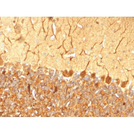 Immunohistochemistry - Anti-PGP9.5 Antibody [SPM574] - BSA and Azide free (A253450) - Antibodies.com