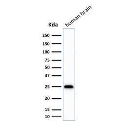 Western Blot - Anti-PGP9.5 Antibody [SPM575] - BSA and Azide free (A253452) - Antibodies.com