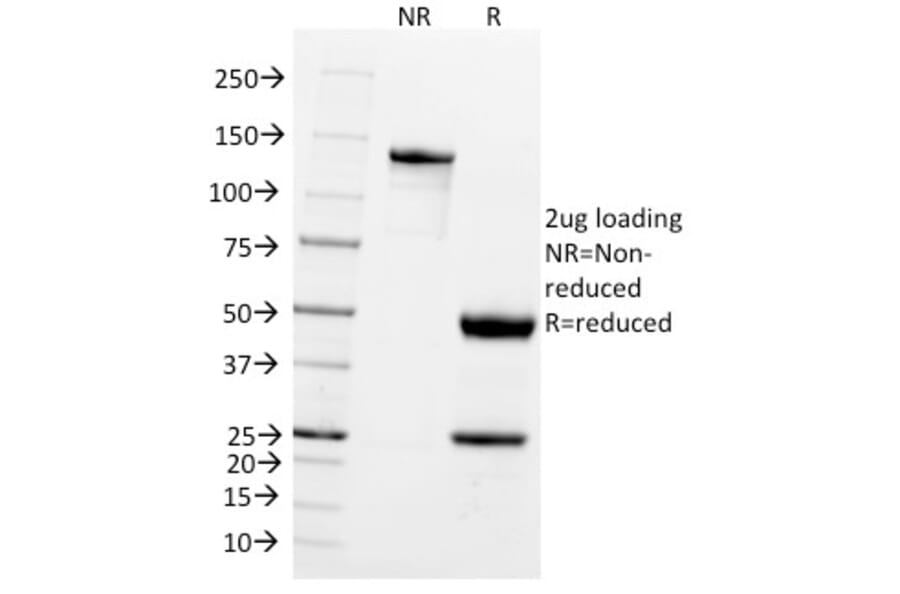 SDS-PAGE - Anti-PGP9.5 Antibody [UCHL1/775] - BSA and Azide free (A253453) - Antibodies.com