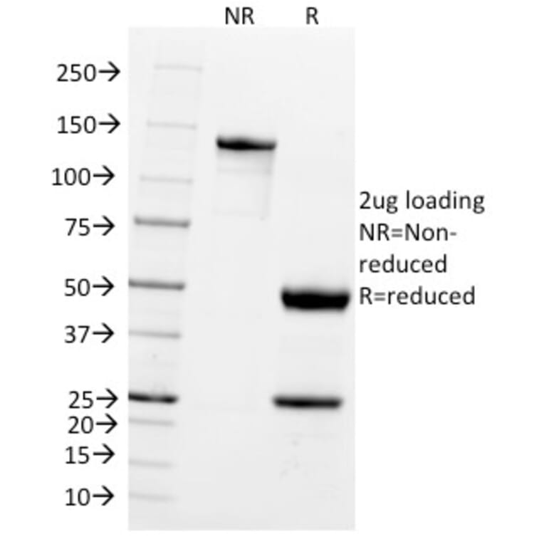 SDS-PAGE - Anti-PGP9.5 Antibody [UCHL1/775] - BSA and Azide free (A253453) - Antibodies.com