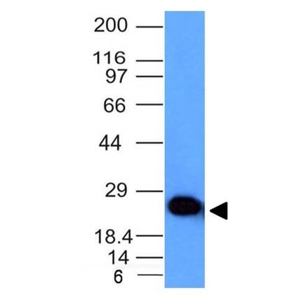 Western Blot - Anti-PGP9.5 Antibody [UCHL1/841] - BSA and Azide free (A253454) - Antibodies.com