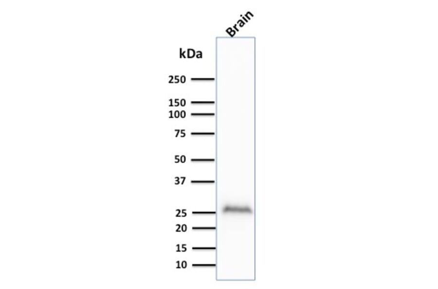 Western Blot - Anti-PGP9.5 Antibody [UCHL1/841] - BSA and Azide free (A253453) - Antibodies.com