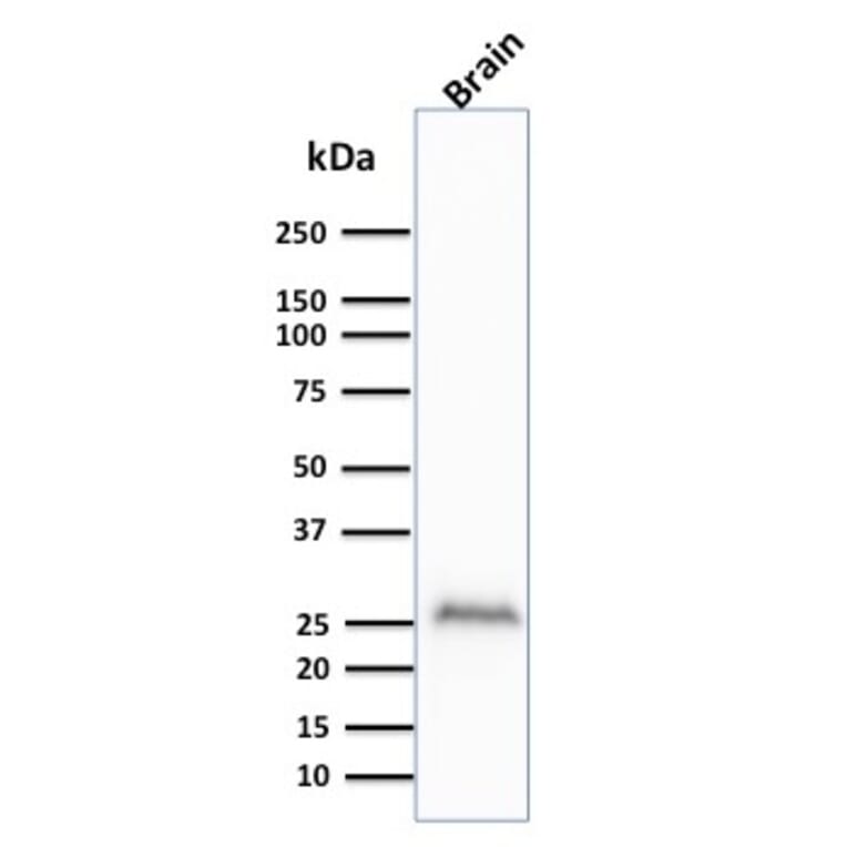 Western Blot - Anti-PGP9.5 Antibody [UCHL1/841] - BSA and Azide free (A253453) - Antibodies.com
