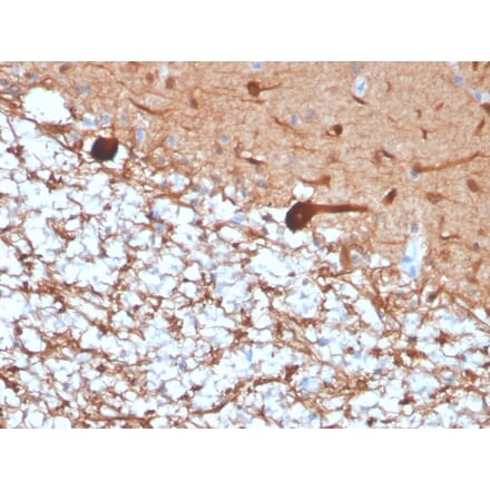Immunohistochemistry - Anti-PGP9.5 Antibody [rUCHL1/4557] - BSA and Azide free (A253456) - Antibodies.com