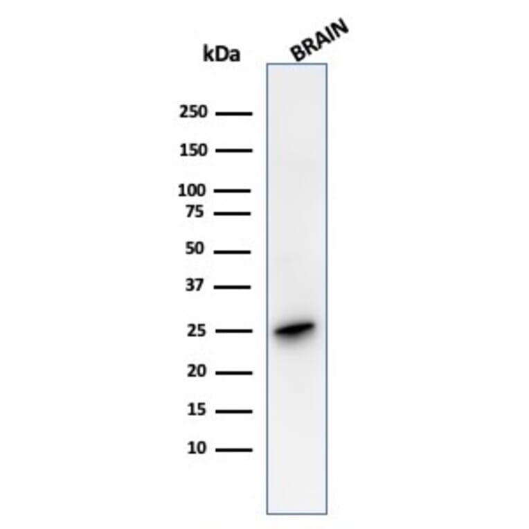 Western Blot - Anti-PGP9.5 Antibody [rUCHL1/4557] - BSA and Azide free (A253456) - Antibodies.com