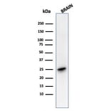 Western Blot - Anti-PGP9.5 Antibody [rUCHL1/4557] - BSA and Azide free (A253456) - Antibodies.com