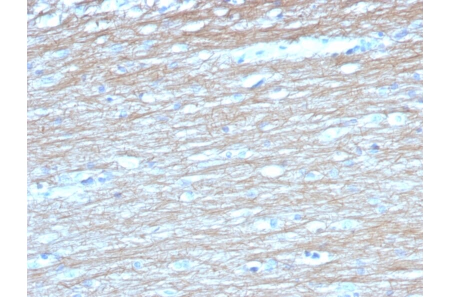 Immunohistochemistry - Anti-PGP9.5 Antibody [UCHL1/4558] - BSA and Azide free (A253457) - Antibodies.com