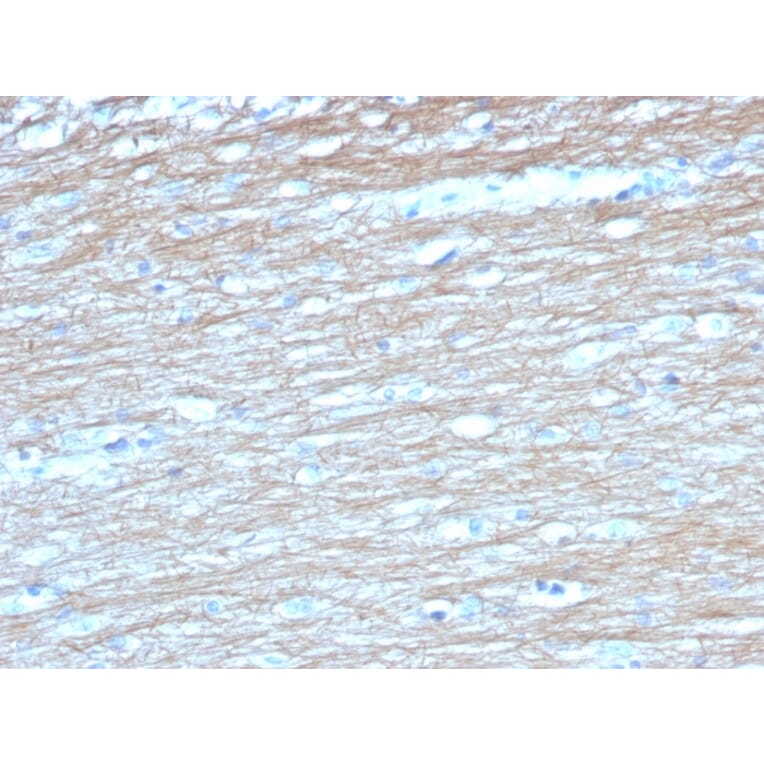 Immunohistochemistry - Anti-PGP9.5 Antibody [UCHL1/4558] - BSA and Azide free (A253457) - Antibodies.com