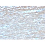 Immunohistochemistry - Anti-PGP9.5 Antibody [UCHL1/4558] - BSA and Azide free (A253457) - Antibodies.com