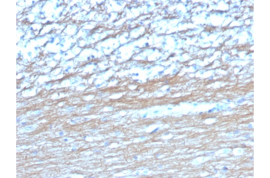 Immunohistochemistry - Anti-PGP9.5 Antibody [UCHL1/4558] - BSA and Azide free (A253457) - Antibodies.com