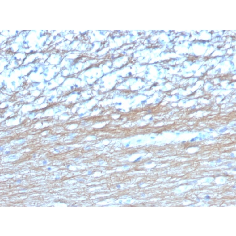 Immunohistochemistry - Anti-PGP9.5 Antibody [UCHL1/4558] - BSA and Azide free (A253457) - Antibodies.com